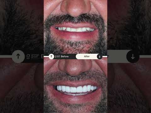 Rio's Smile Makeover