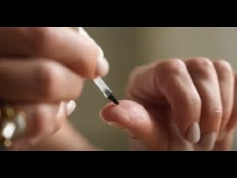 Warzen schnell und kinderleicht loswerden| WARZIN gegen Warzen