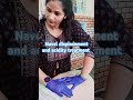Navel Displacement And Acidity Treatment By Dr Deepanshi Chiropractic Tail Bone Specialist