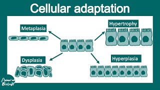 Cellular adaptations | Hypertrophy, hyperplasia, Atrophy and Metaplasia | USMLE step 1