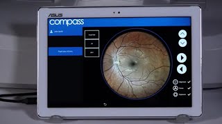 CenterVue COMPASS Operation