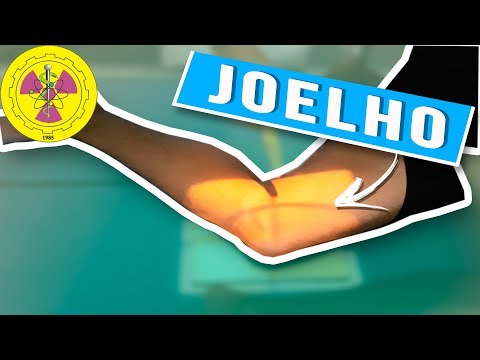 POSITIONING: ROUTINE KNEE