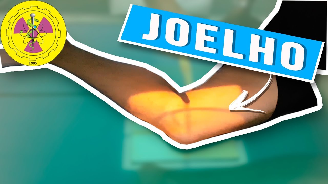 POSITIONING: ROUTINE KNEE