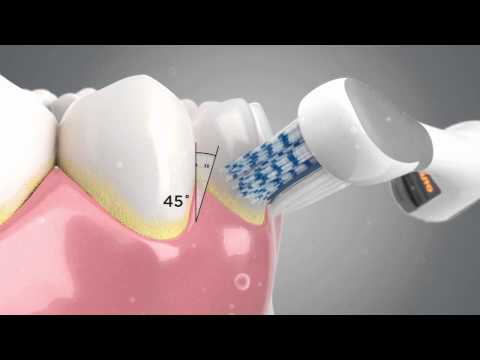The Technology behind the Colgate® ProClinical® A1500 Electric Toothbrush