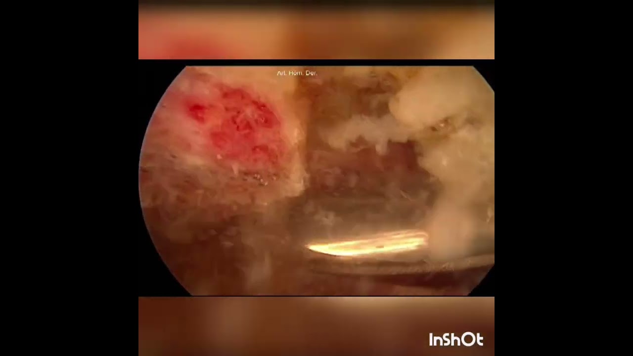 Jorge Luis Córdova Fonseca-10