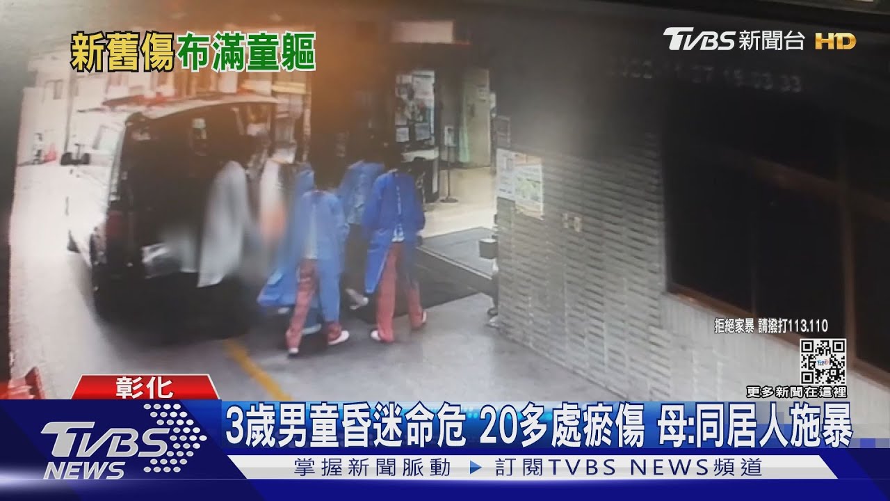 3歲男童昏迷命危!20多處瘀傷 母:同居人施暴