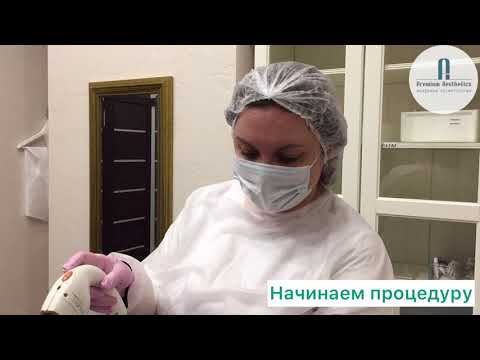 ЛАЗЕРНАЯ ЭПИЛЯЦИЯ С ЕЛЕНОЙ ОЛЕЙНИЧЕНКО.25.01.2021 Г.
