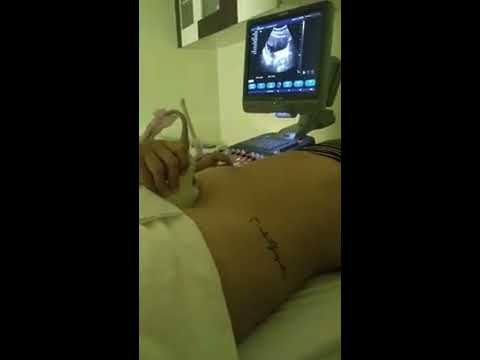 1 Ultrassonografia ❤️