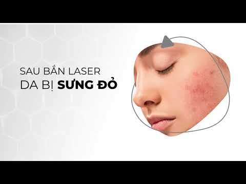 Laser kết hợp với LED Phototherapy