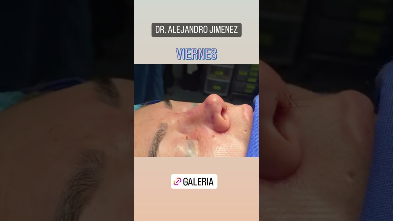 Alejandro Jimenez Garcia-54