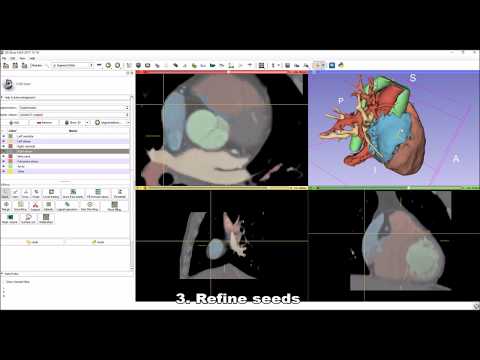 Whole Heart Segmentation from Cardiac CT in 10 Minutes