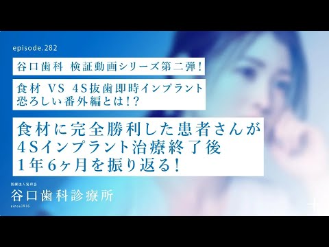 第282話 4Sコンセプト抜歯即時埋入インプラント治療後1年6ヶ月の患者さんインタビュー‼️フレンチ VSインプラント驚愕の番外編⁉️-恐ろしい食材とは❓