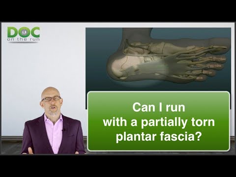 Can I Run with a Partial Rupture of the Plantar Fascia?