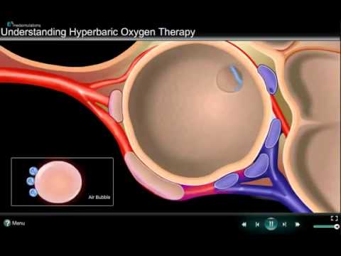 HBO2T STUDIO  How Hyperbaric Oxygen Therapy Works   KAKO JE UČINKOVIT HIPERBARIČNI KISIK
