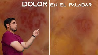Me duele el paladar ¿qué hago - caso resuelto
