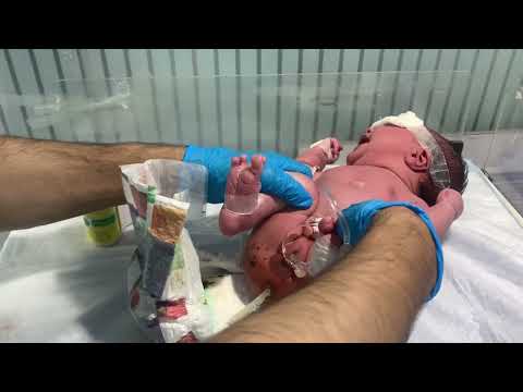 How to Help a Constipated Newborn | Suppository Guide for Parents 😱