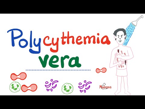 Polycythemia Vera (PV) - Myeloproliferative Neoplasm (MPN) - Erythrocytosis - Hematology