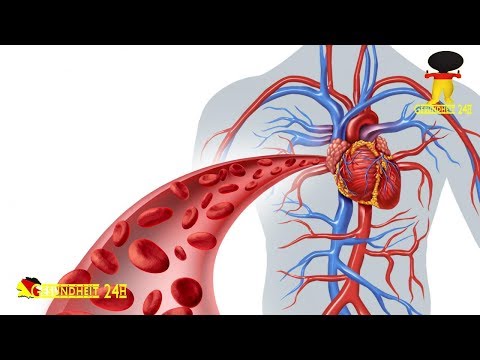 Enzephalopathie in portale Hypertension Automatisches Blutdruckmeßgerät und UA-767