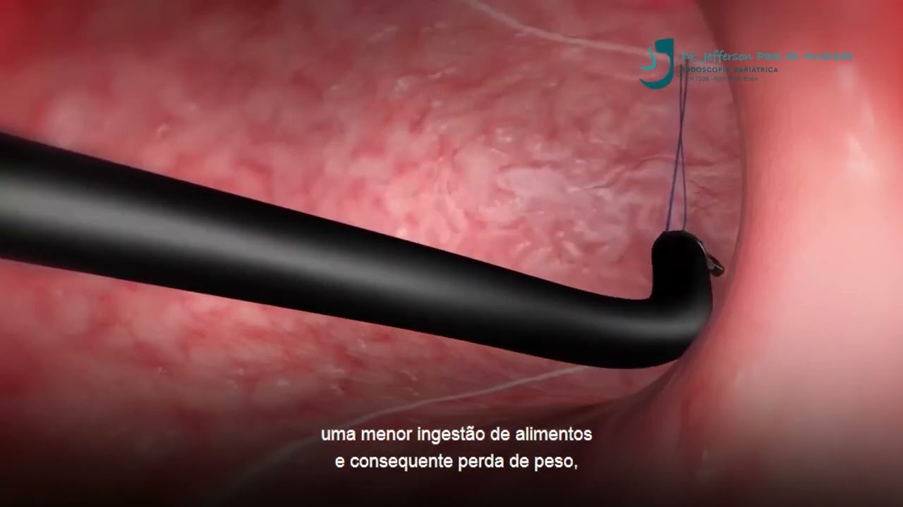 Jefferson Paes De Andrade-51