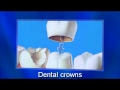 Invisalign 78731 512 273 3533