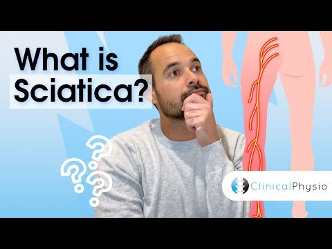 Anatomie & Behandlungswissen Videos – Interaktives Nachschlagewerk für Physio, Massage, Therapie 42 What is Sciatica?! | Expert Physio explains anatomy, diagnosis and key strategies for treatment!