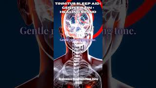 Download lagu Tinnitus Relief Sound Therapy | Powerful 528 Hz Frequency Rain Sounds | Pure Binaural Beats mp3 Download lagu Tinnitus Relief Sound Therapy | Powerful 528 Hz Frequency Rain Sounds | Pure Binaural Beats mp3