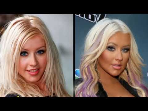 49 Celebrities Before and After Plastic Surgery