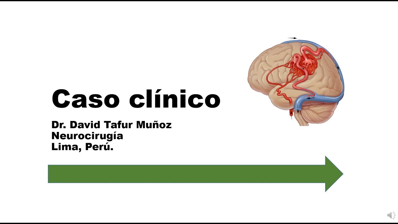 David Tafur Muñoz-2449