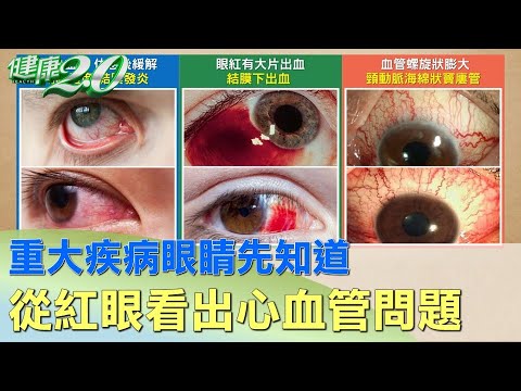 外眼角紅
