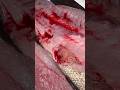 I ATE TAPEWORMS