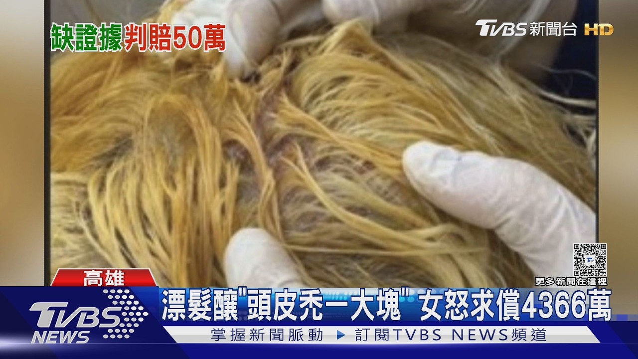 影音/漂髮「頭皮禿一塊」! 女赴倫敦治療求償4366萬 髮型師:碰瓷