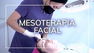 Evita la deshidratación de tu piel con la Mesoterapia Facial de vitaminas y Ácido Hialurónico