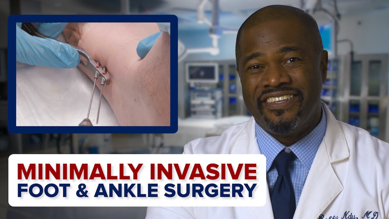 Watch video titled Minimally Invasive Foot & Ankle Surgery | Penn Orthopaedics on YouTube