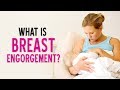 What Is Breast Engorgement Dr Pankaj Parekh Dr Priti Gangan Lectsian Series Child And You