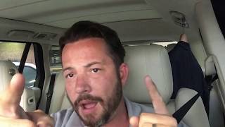 Hair Replacement Men's Hair System Review Lets talk about those bleached knots