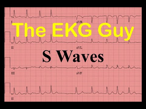 EKG/ECG S Waves - Question 24.0 | The EKG Guy