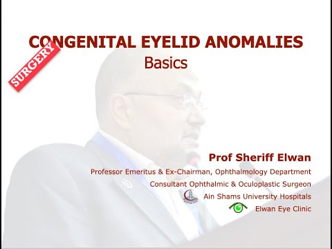 Surgery: Congenital Lid Anomalies