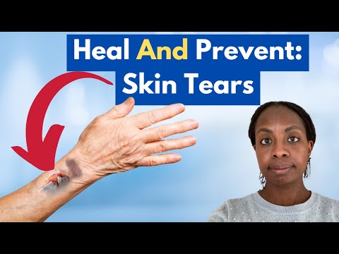 Skin Tears: Stop the Damage, Start the Healing