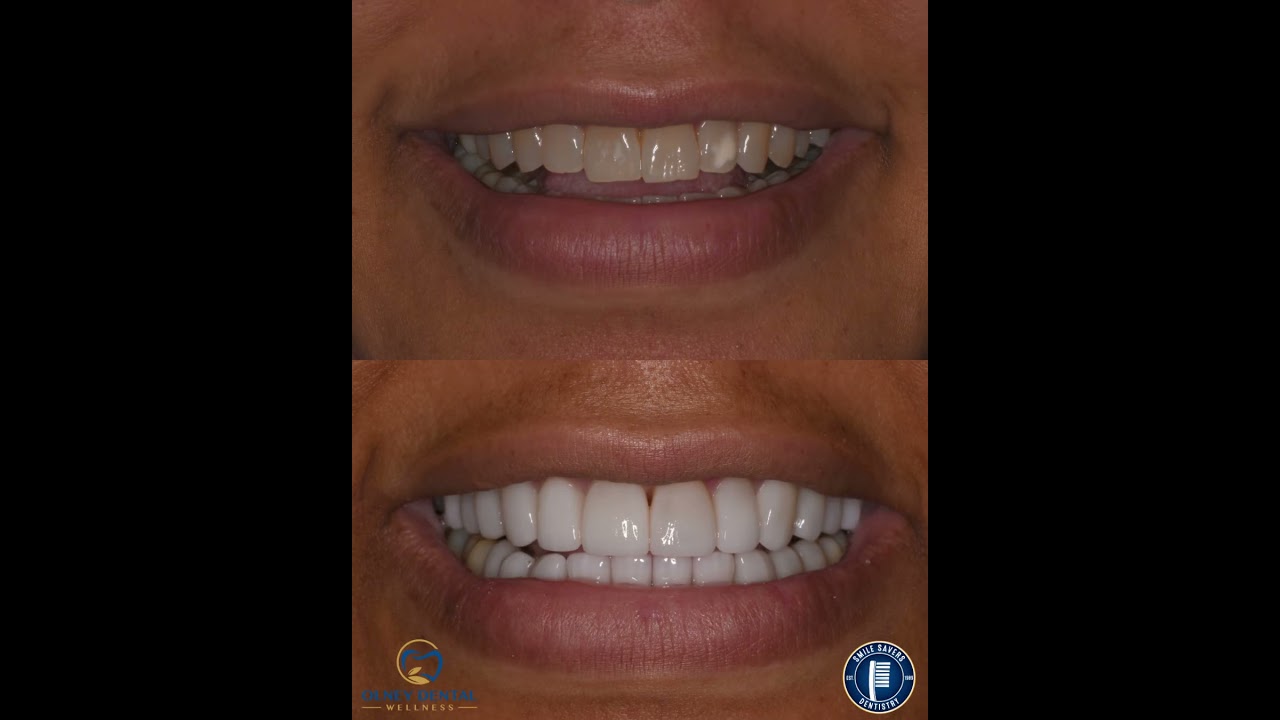 Smile Gallery Video 7