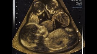 10 - No Me Puedes Dejar Asi