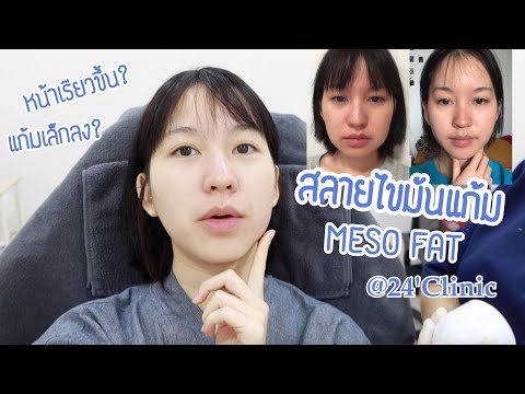 เมโส แฟต