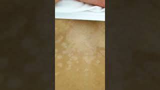 Download lagu How to treat fungus on the skin mp3