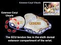 Extensor Carpi Ulnaris Everything You Need To Know Dr Nabil Ebraheim