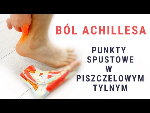 Achilles Pain - Trigger Points in the Tibialis Posterior Muscle