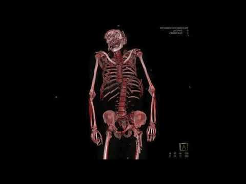 [FREE FOR PROFIT] LIL DARKIE NO MELODY TYPE BEAT - “NO TITLE” (PROD. GR4VE)