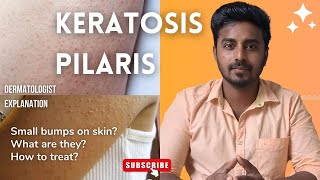 Small Bumps on Skin | Keratosis Pilaris - அப்படினா என்ன? அதுக்கு என்ன பண்ணலாம்? Skincare tips tamil