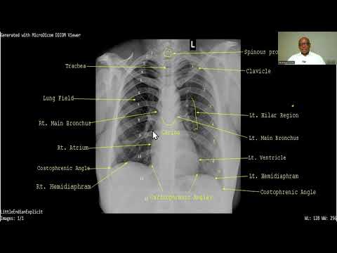 RADIOGRAPHIC ANATOMY OF THE CHEST MADE SIMPLE FOR 200 LEVEL MEDICAL & ALLIED HEALTH ANATOMY STUDENTS