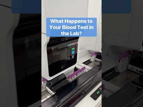 What happens to your blood test in the lab.