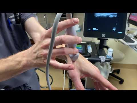 Scanning the Scaphoid