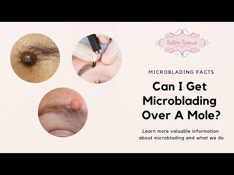 Can I Get Microblading Over A Mole?